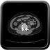 Clinical case 5 - Polytrauma due to road accident of single light vehicle against plane tree, not wearing seatbelt