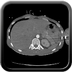 Clinical case 12 - Polytrauma with severe cranioencephalic trauma