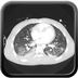 Clinical case 8 - Polytrauma due to a fall of a few meters following a loop while paragliding