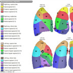 Lung anatomy lung segmentation Lung anatomy lung segmentation