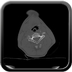 Clinical case 3 - Polytrauma due to a fall from a height of 5 m