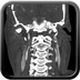 Clinical case 12 - Polytrauma with severe cranioencephalic trauma