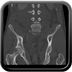 Clinical case 8 - Polytrauma due to a fall of a few meters following a loop while paragliding