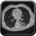 Clinical case 3 - Polytrauma due to a fall from a height of 5 m