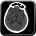 Clinical case 5 - Polytrauma due to road accident of single light vehicle against plane tree, not wearing seatbelt