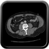 Clinical case 2 - AVP polytrauma high velocity