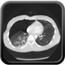 Clinical case 1 - Polytrauma due to road traffic accident, light vehicle against plane tree