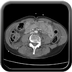 Clinical case 13 - Polytrauma due to a high-speed car accident (rear passenger with belt)