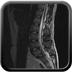Clinical case 3 - Polytrauma due to a fall from a height of 5 m