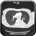 Clinical case 12 - Polytrauma with severe cranioencephalic trauma