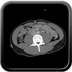 Clinical case 6 - Polytrauma severe cranial injury following road traffic accident