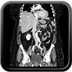 Abcès hépatiques du foie droit post diverticulite.  TDM Abdomen Axial Temps veineux