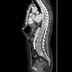 Clinical case 4 - Polytrauma with abdominal wound