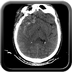 Clinical case 12 - Polytrauma with severe cranioencephalic trauma