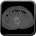 Clinical case 3 - Polytrauma due to a fall from a height of 5 m