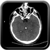 Clinical case 6 - Polytrauma severe cranial injury following road traffic accident