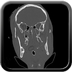 Clinical case 6 - Polytrauma severe cranial injury following road traffic accident