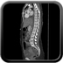 Clinical case 10 - Polytrauma due to road traffic accident, at 90 kmph, would appear to have been thrown over a bridge