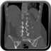 Clinical case 3 - Polytrauma due to a fall from a height of 5 m