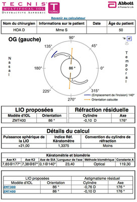 Cataracte sous capsulaire postérieure et astigmatisme cornéen - Implantation multifocale torique Calculateur IOL OG