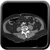 Polytrauma with abdominal wound from a sharp instrument Chest, Abdomen and Pelvis, Arterial phase, Axial plane