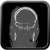 Clinical case 12 - Polytrauma with severe cranioencephalic trauma