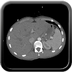 Clinical case 6 - Polytrauma severe cranial injury following road traffic accident