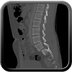 Clinical case 3 - Polytrauma due to a fall from a height of 5 m