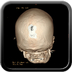 Clinical case 12 - Polytrauma with severe cranioencephalic trauma