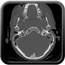 Clinical case 13 - Polytrauma due to a high-speed car accident (rear passenger with belt)