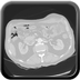 Clinical case 4 - Polytrauma with abdominal wound