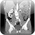 Diverticule de Meckel invaginé Entéroscanner axial temps portal