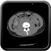 Clinical case 6 - Polytrauma severe cranial injury following road traffic accident