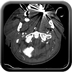 Clinical case 12 - Polytrauma with severe cranioencephalic trauma