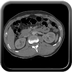 Clinical case 3 - Polytrauma due to a fall from a height of 5 m