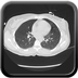 Clinical case 10 - Polytrauma due to road traffic accident, at 90 kmph, would appear to have been thrown over a bridge