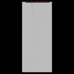 Angioplastie distale des artères jambières Interventionnel Angioplastie distale des artères jambières Interventionnel