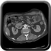 Clinical case 4 - Polytrauma with abdominal wound