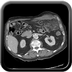 Clinical case 4 - Polytrauma with abdominal wound