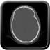 Clinical case 10 - Polytrauma due to road traffic accident, at 90 kmph, would appear to have been thrown over a bridge