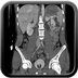 Clinical case 8 - Polytrauma due to a fall of a few meters following a loop while paragliding