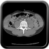 Clinical case 1 - Polytrauma due to road traffic accident, light vehicle against plane tree