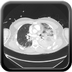 Clinical case 11 - Polytrauma due to a very high-speed single light vehicle road traffic accident