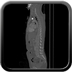 Clinical case 5 - Polytrauma due to road accident of single light vehicle against plane tree, not wearing seatbelt