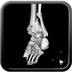 Polytrauma due to road accident of single light vehicle against plane tree, not wearing seatbelt Head CT, Axial plane, Soft tissue window