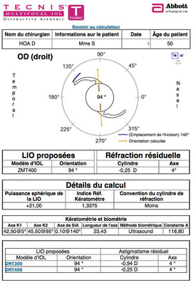Cataracte sous capsulaire postérieure et astigmatisme cornéen - Implantation multifocale torique Calculateur IOL OD