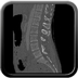 Clinical case 14 - Polytrauma due to high-speed road traffic accident, light vehicle against light vehicle, patient driving and wearing belt