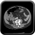 Clinical case 9 - Polytrauma patient struck by a foal in a field