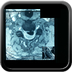 Compression médullaire en C2 post-laminectomie TDM RACHIS CERVICAL